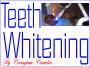 Teeth Whitening Deals London! Teeth Whitening For 2 People Only £44.50 Each